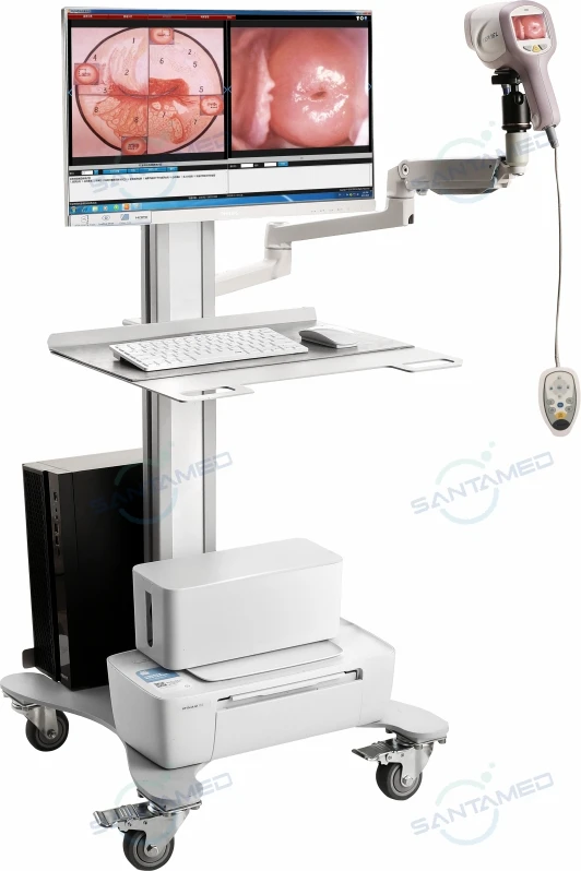 Plné HD Digital Video Colposcope